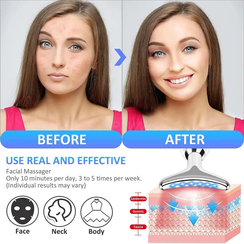 3-Color  Facial Massage Device